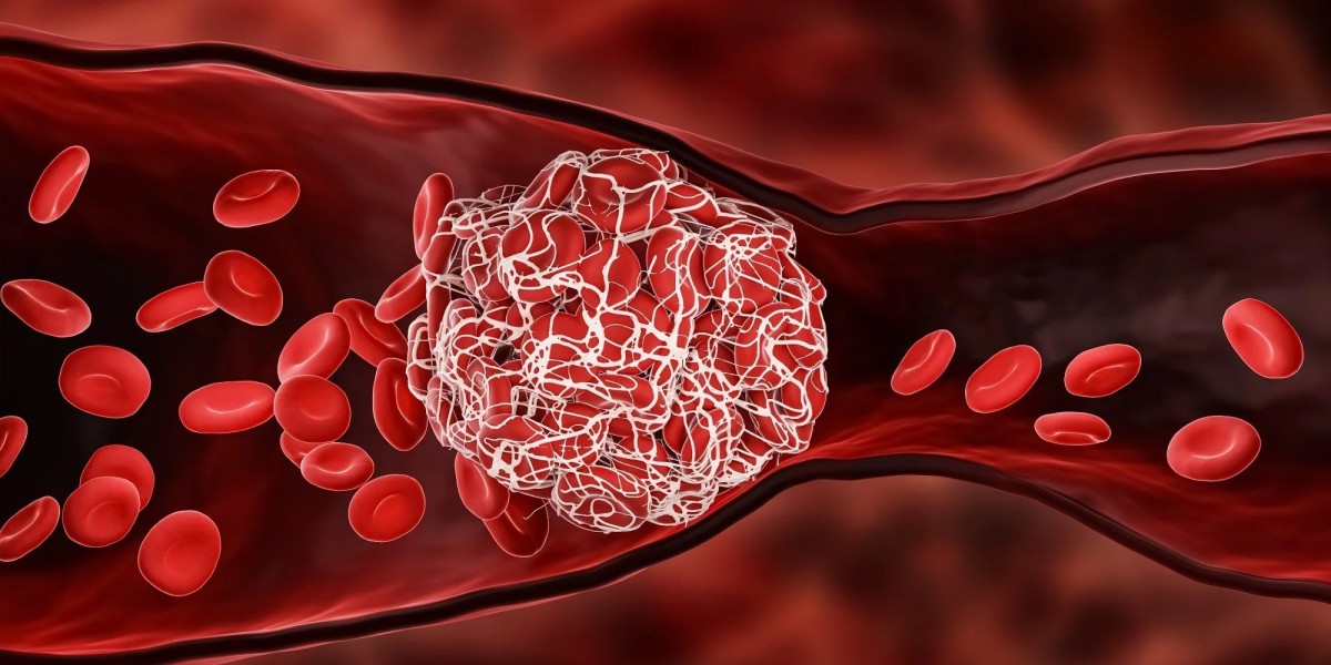Thrombus Treatment Market Research on Expanding Industry Worth To USD 69.94 Billion by 2030