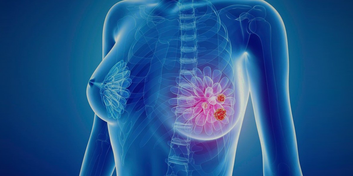 Global Fibrocystic Breasts Diagnostics and Treatment Market Research on Prones Hindering the Industry Growth